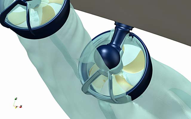 schottel-srp-d SRP-D thruster (Schottel)